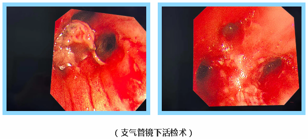 QQ20260511-150759.png