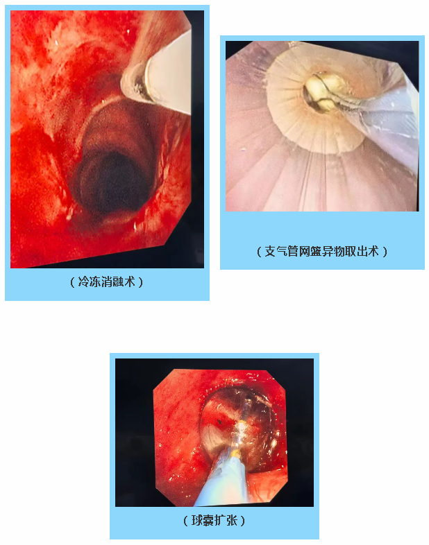 QQ20260511-150619.png